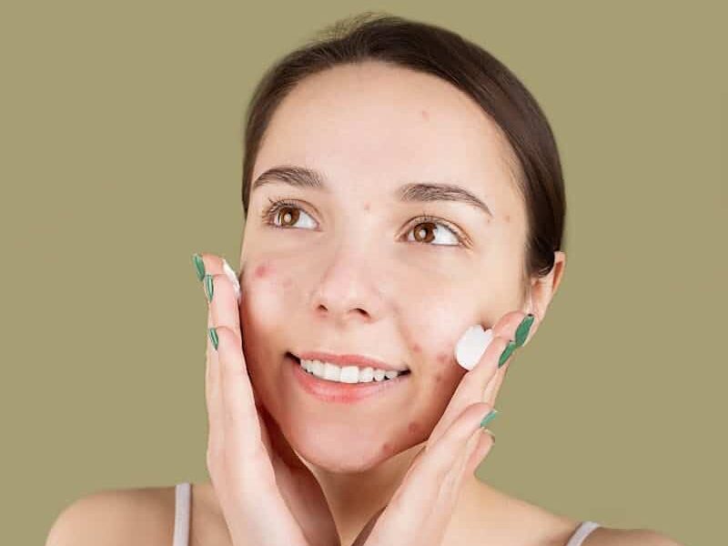 Smiling Teenager Applying a Facial Cream on Her Face